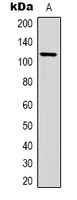 IGFN1 Rabbit Polyclonal Antibody