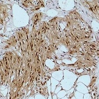 IKB alpha Rabbit Polyclonal Antibody