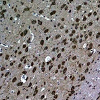 LC3B Rabbit Polyclonal Antibody