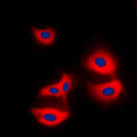 LC3B Rabbit Polyclonal Antibody
