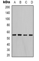 LDHD Rabbit Polyclonal Antibody