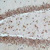 NMBR Rabbit Polyclonal Antibody