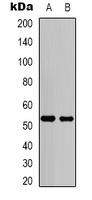 p53 Rabbit Polyclonal Antibody