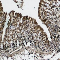 p53 Rabbit Polyclonal Antibody