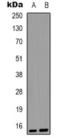 S100-A1 Rabbit Polyclonal Antibody