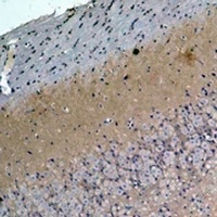 S100-A1 Rabbit Polyclonal Antibody