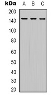 SLC12A4 Rabbit Polyclonal Antibody