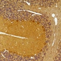 SLC12A4 Rabbit Polyclonal Antibody
