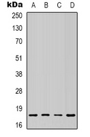 SOD1 Rabbit Polyclonal Antibody
