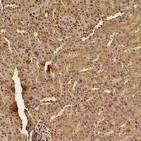 SOD1 Rabbit Polyclonal Antibody