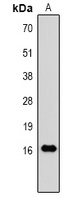 TNF alpha Rabbit Polyclonal Antibody