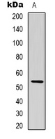 TRIM72 Rabbit Polyclonal Antibody