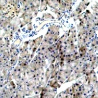 TRIM72 Rabbit Polyclonal Antibody