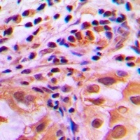 FOXO1 (Phospho-S256) Antibody