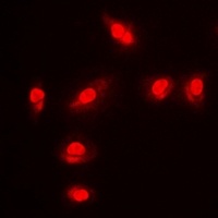 FOXO1 (Phospho-S256) Antibody