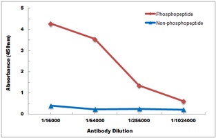 FOXO1 (Phospho-S256) Antibody