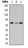 Estrogen Receptor alpha (Phospho-S104) Antibody