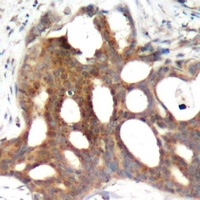 Estrogen Receptor alpha (Phospho-S104) Antibody