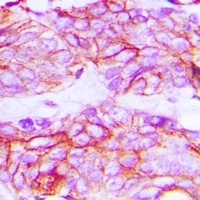 VEGFR2 (Phospho-Y1214) Antibody
