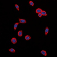 VEGFR2 (Phospho-Y1214) Antibody