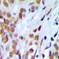 Lupus La (Phospho-S366) Antibody