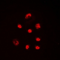 Lupus La (Phospho-S366) Antibody