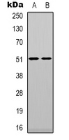 TPH1 Rabbit Polyclonal Antibody