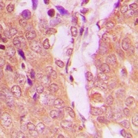 TPH1 Rabbit Polyclonal Antibody