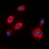 TPH1 Rabbit Polyclonal Antibody