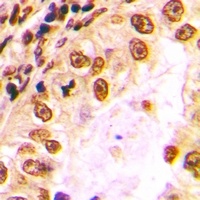 Nibrin Rabbit Polyclonal Antibody