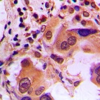 BRCA1 (Phospho-S1423) Antibody