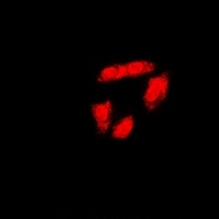 BRCA1 (Phospho-S1423) Antibody