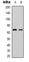 PAK1 Rabbit Polyclonal Antibody