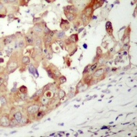 PAK1 Rabbit Polyclonal Antibody