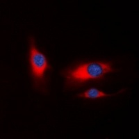 PAK1 Rabbit Polyclonal Antibody