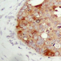 FAP alpha Rabbit Polyclonal Antibody