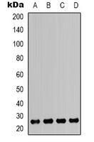 HMGB1 Rabbit Polyclonal Antibody
