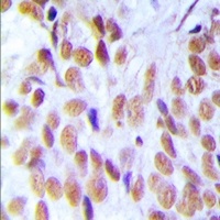 HMGB1 Rabbit Polyclonal Antibody