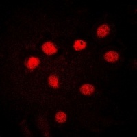 HMGB1 Rabbit Polyclonal Antibody
