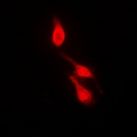 p38 (Phospho-Y182) Antibody
