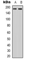 HER2 Rabbit Polyclonal Antibody