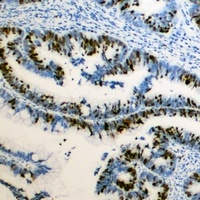 RB1 (Phospho-S795) Antibody