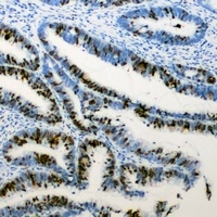 RB1 (Phospho-S807) Antibody