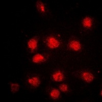 RB1 (Phospho-S807) Antibody