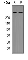 mTOR (Phospho-T2446) Rabbit Polyclonal Antibody