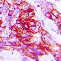 Syntaxin 1A (Phospho-S14) Antibody