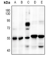 SMAD2 Rabbit Polyclonal Antibody