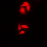 SMAD2 Rabbit Polyclonal Antibody