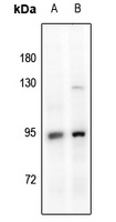 Glucocorticoid Receptor Rabbit Polyclonal Antibody