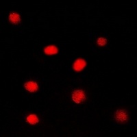Glucocorticoid Receptor Rabbit Polyclonal Antibody